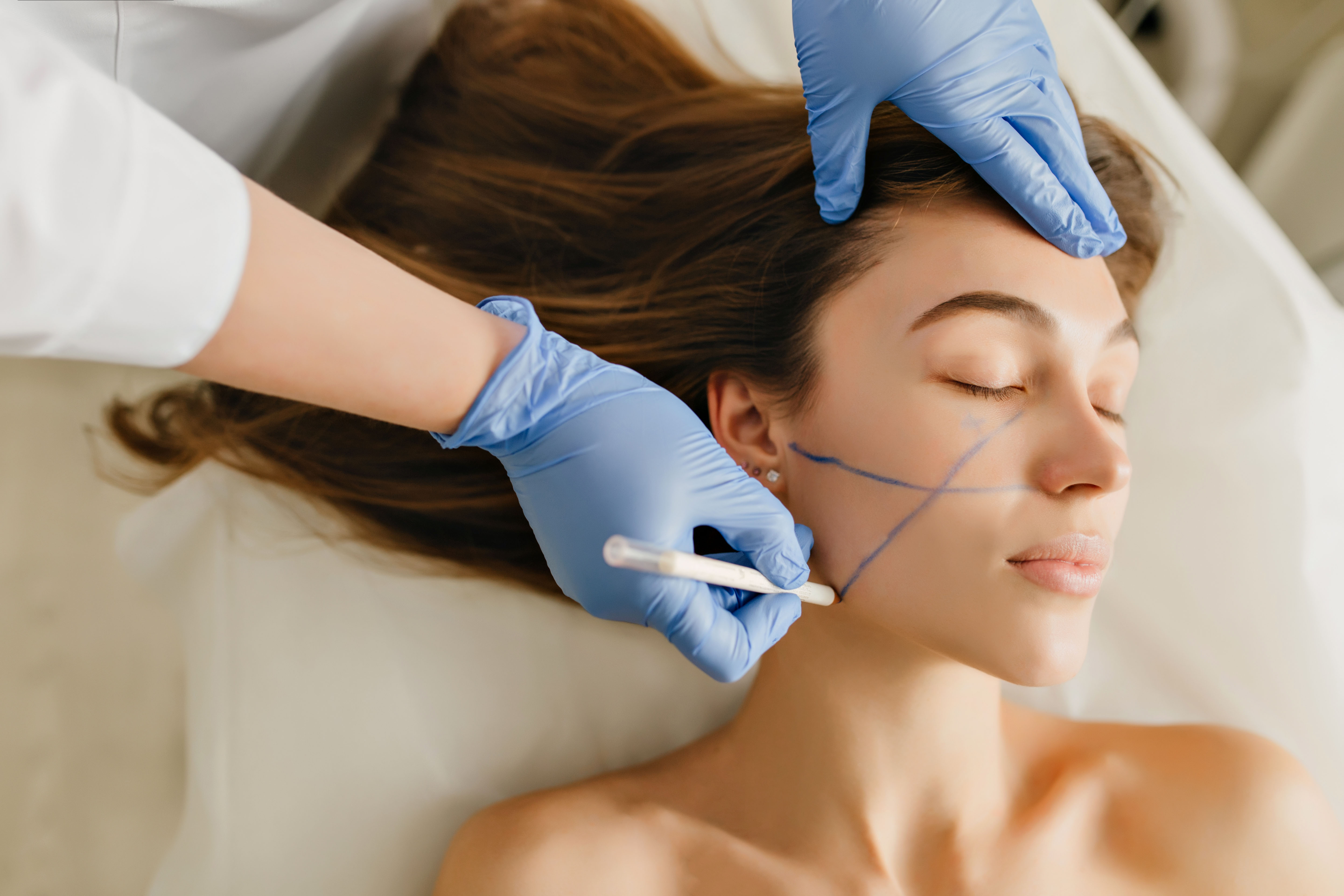 Facial Fillers